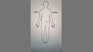 Lokacija kronične bolečine v križu levenem predelu.